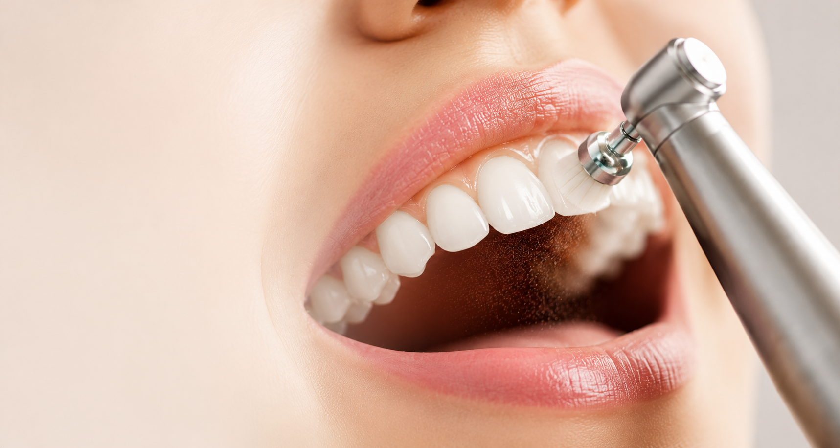 Igienizare dentară profesională la Zento Clinic